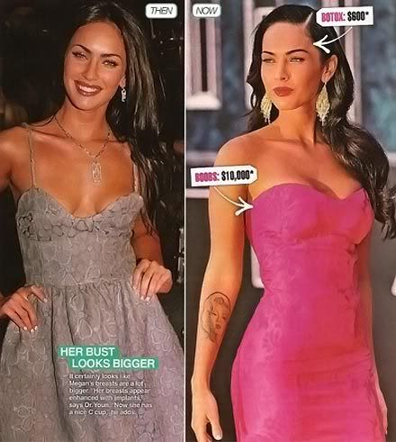 megan fox before and after. girlfriend JustAnswer.com/Surgery ·12 efore and after surgery megan fox.